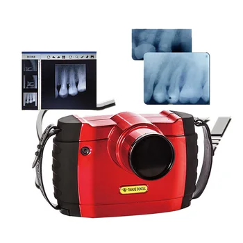 Fabrika toptan fiyat BLX - 10 mikroişlemci kontrolü dijital diş röntgeni diş sensörü